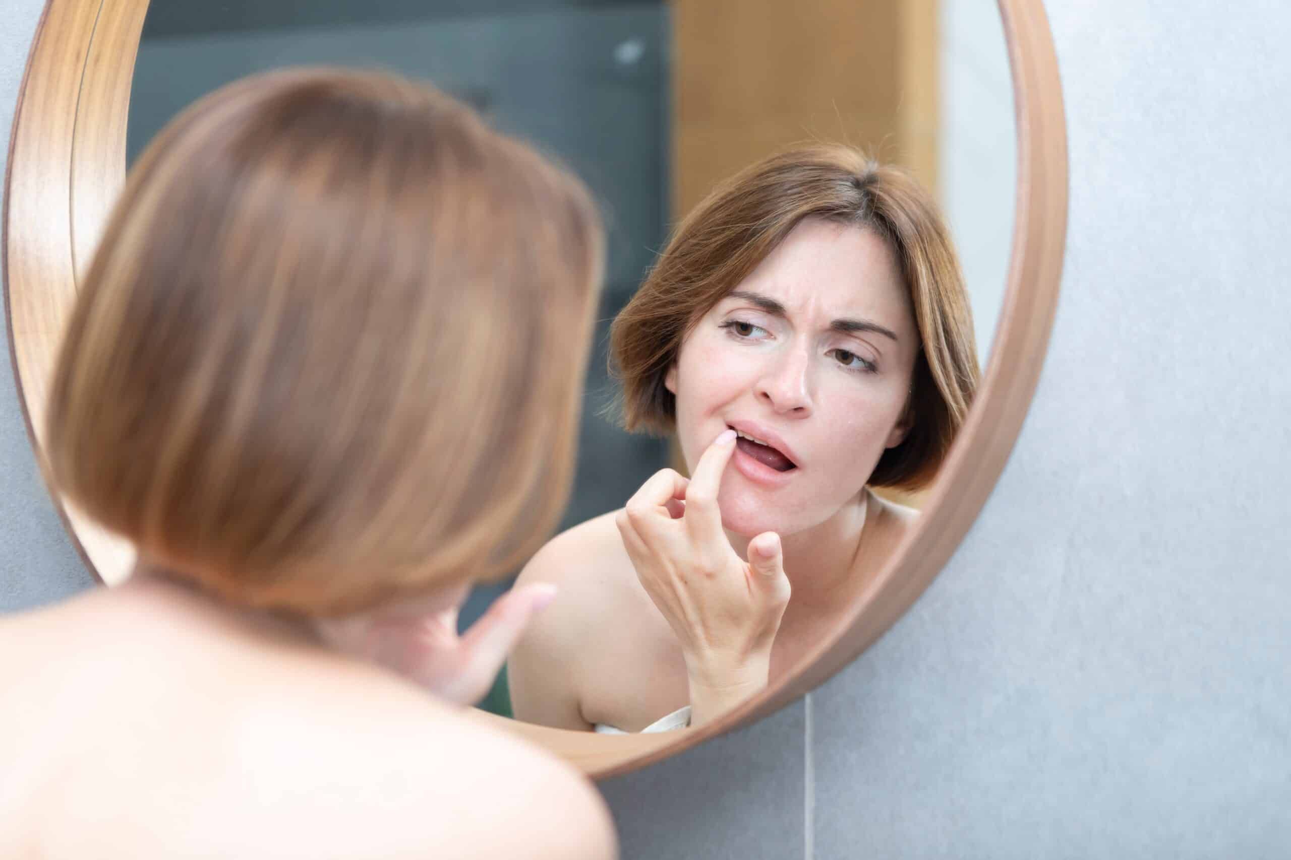 Frau betrachtet besorgt ihre Lippe oder Zähne im Spiegel und untersucht eine mögliche Veränderung im Mundbereich
